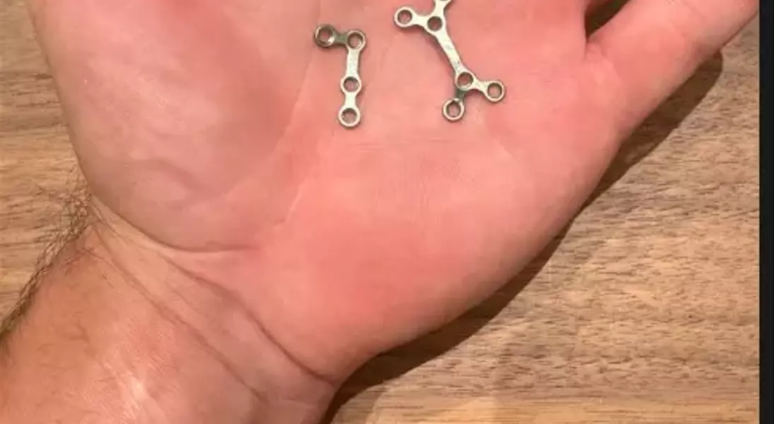 Single Slide