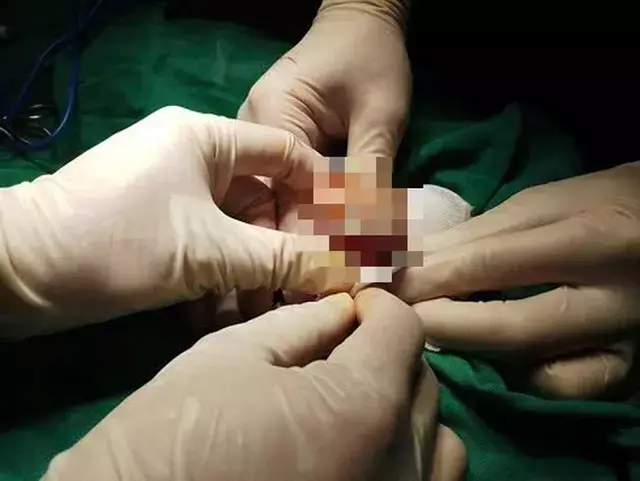 Single Slide