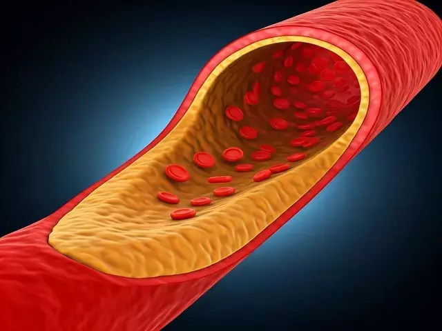 Single Slide