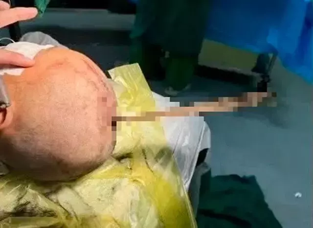 Single Slide