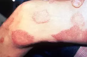 Single Slide