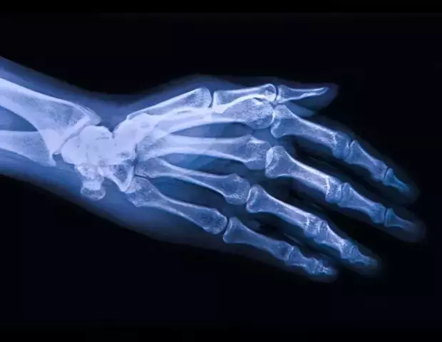 Single Slide