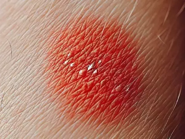 Single Slide