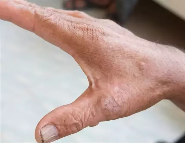 Single Slide