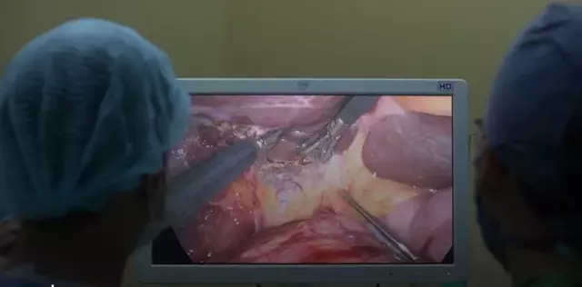Single Slide