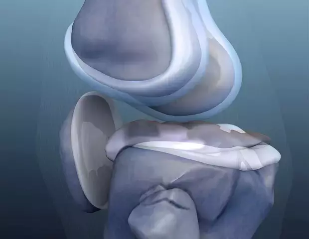 Single Slide