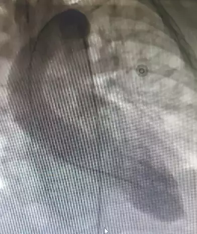 Single Slide