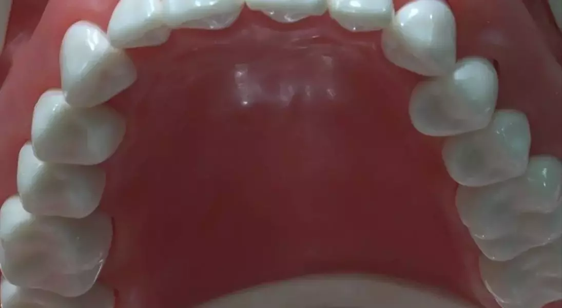 Single Slide