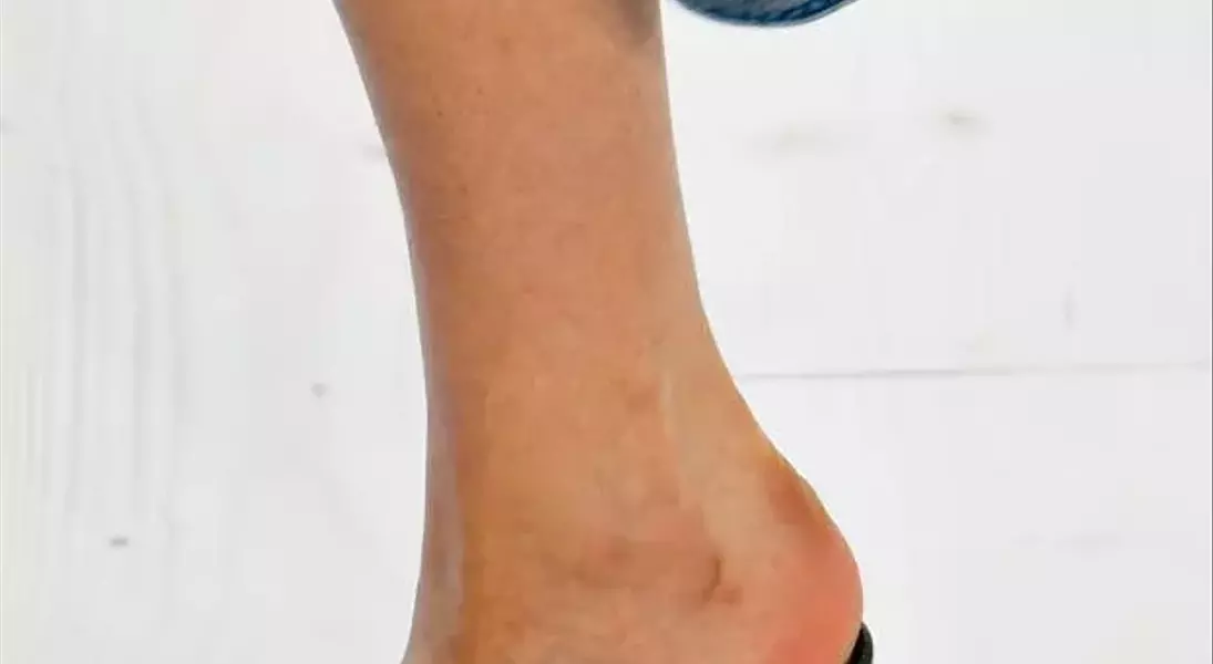 Slide 4