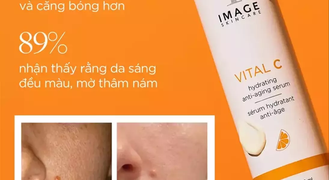 Slide 13