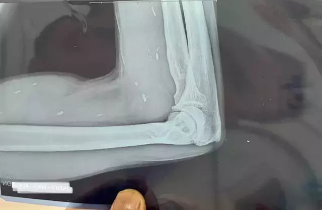 Single Slide