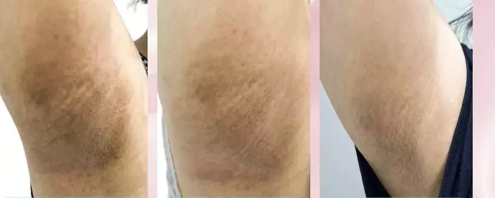 Single Slide