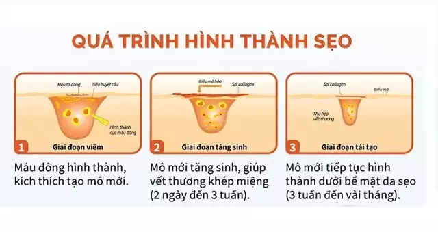 Slide 6