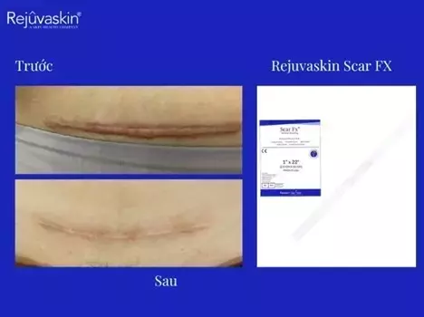 Slide 9