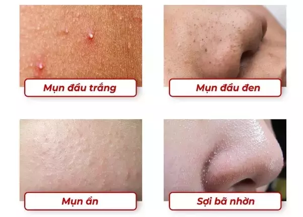 Slide 6