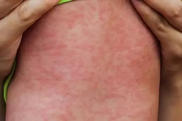 Single Slide