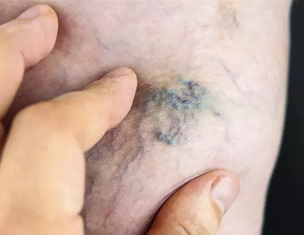 Single Slide