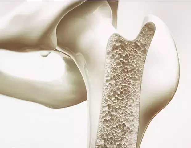 Single Slide