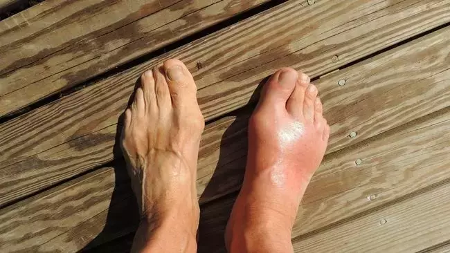 Single Slide