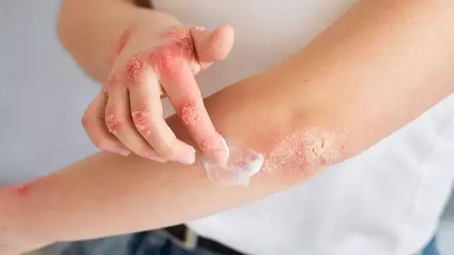 Single Slide