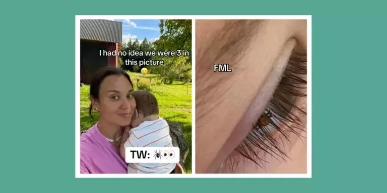 Slide 15