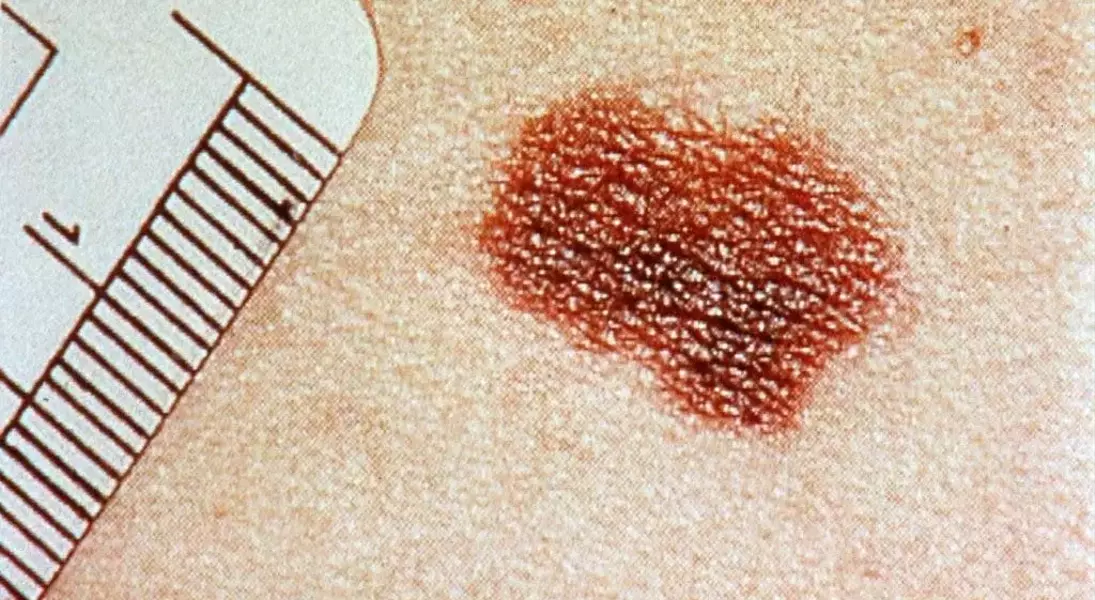 Single Slide