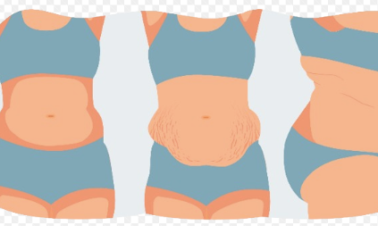 Benefits of Participating in Paid Tummy Tuck Trial! – Learn How to Join and Get Paid!