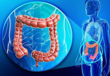 Colon Cancer: Causes, Symptoms, and Prevention