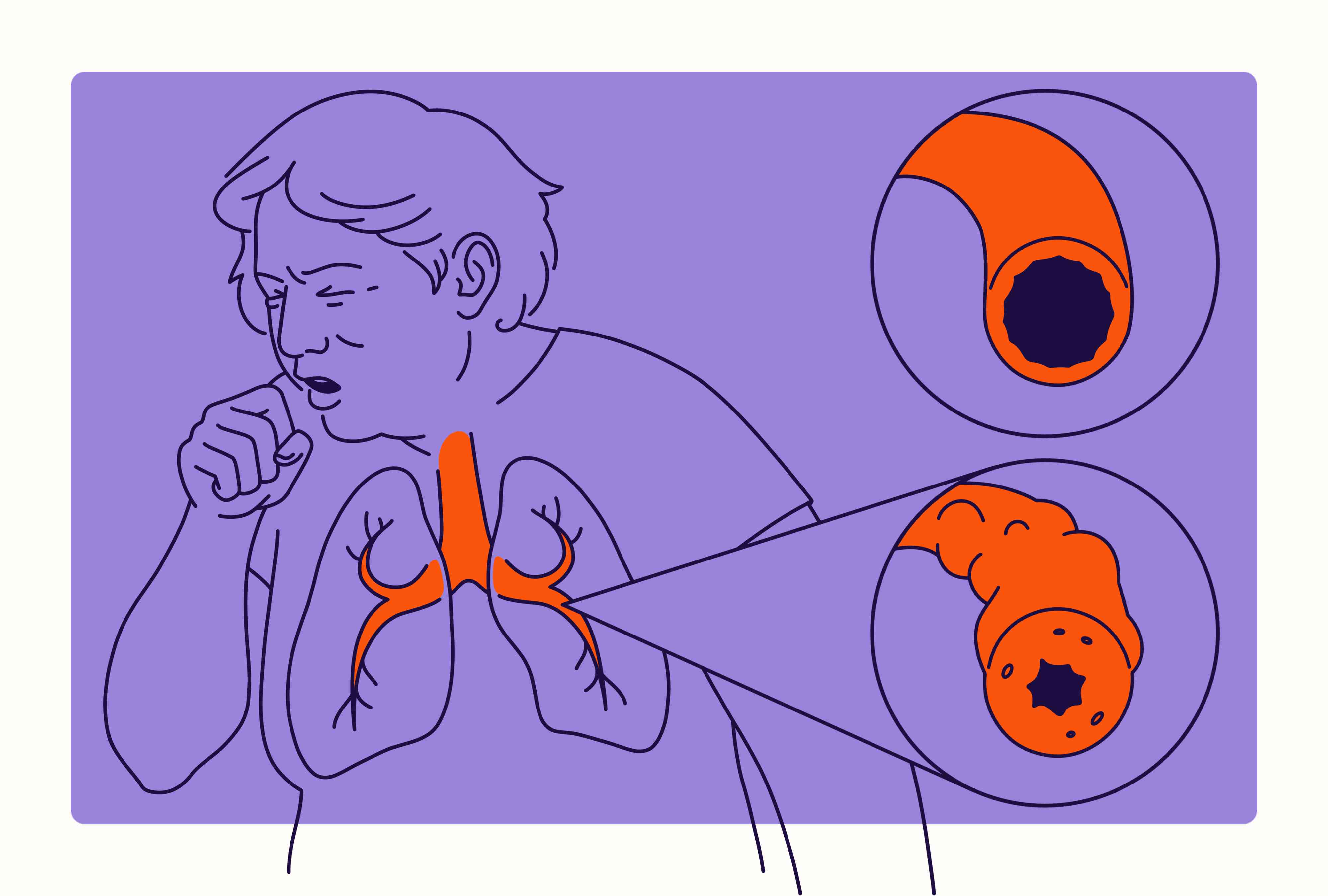 Read this for a higher SURVIVALITY rate on COPD!