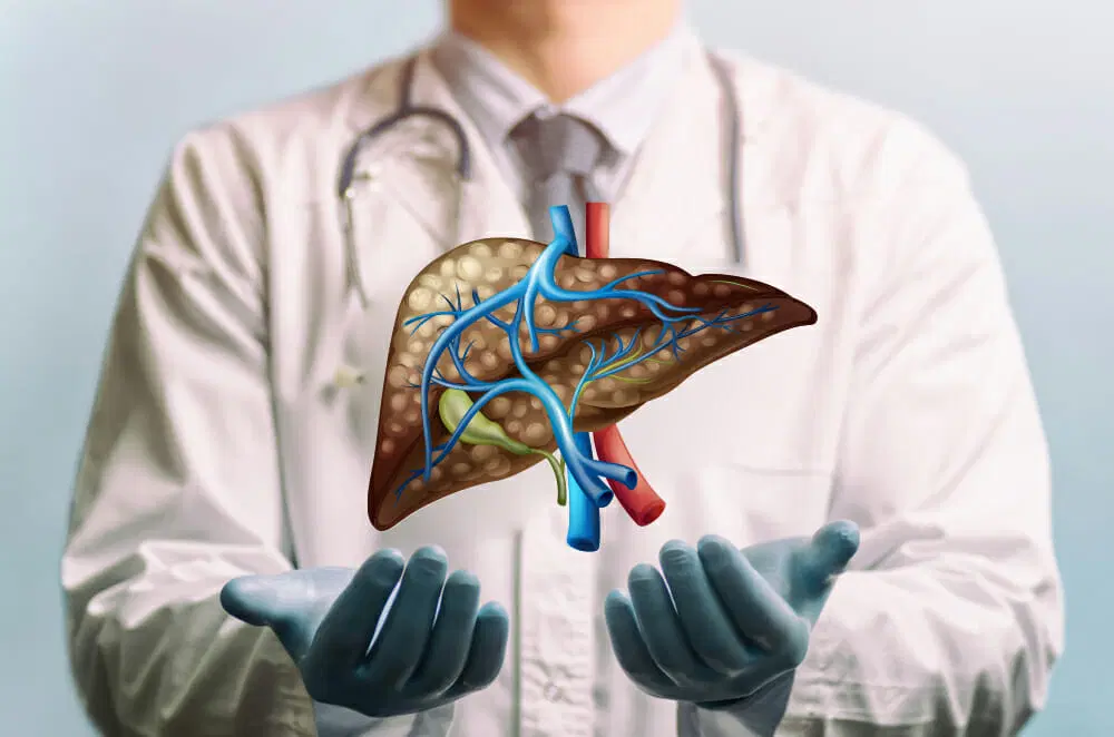 Top Foods to Avoid for Preventing Fatty Liver Symptoms: Essential Dietary Tips