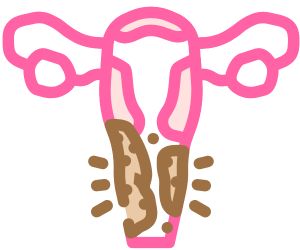 Say goodbye to itching in 3 days: the ultimate self-help guide for vaginitis