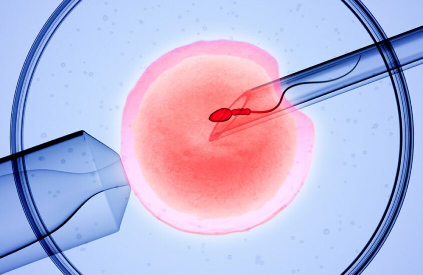 Understanding IVF Treatment: A Comprehensive Overview of the Process and Considerations