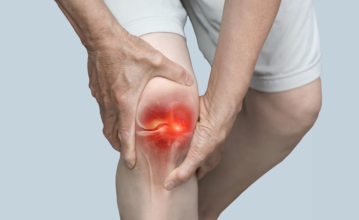 Advances in Identifying and Treating Psoriatic Arthritis