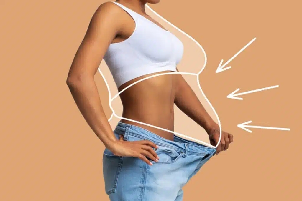 Things to know before liposuction