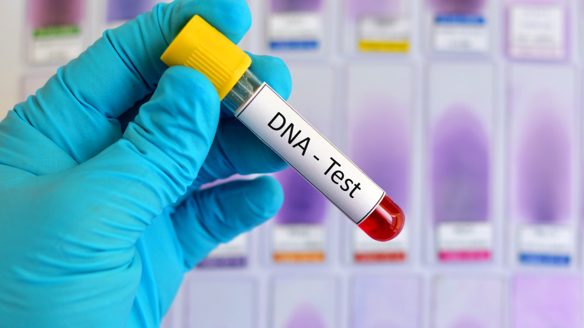 Understanding Online DNA Tests: What You Need to Know Before You Spit