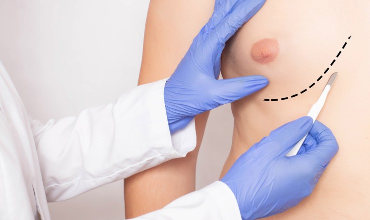 Gynecomastia Operation: What It Really Means for Men