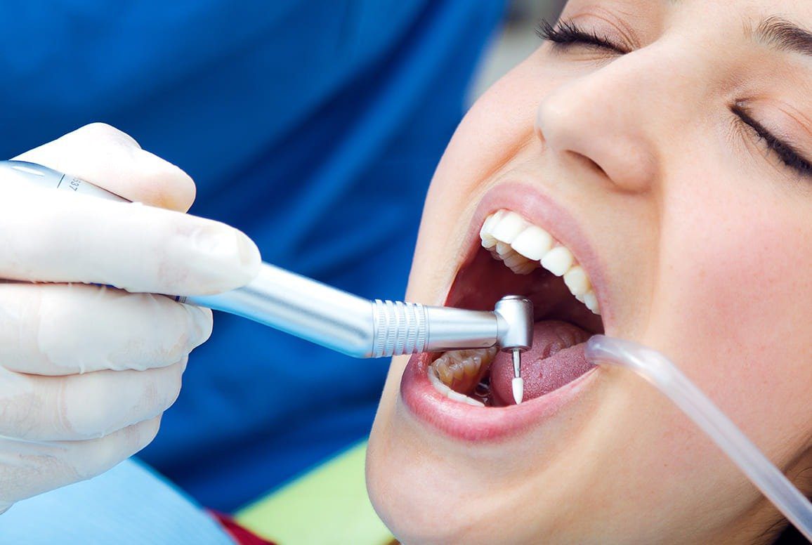 Root Canal Treatment — What to Expect, When to Seek Care, and Aftercare