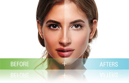 Photofacial: A Modern Solution for Skin Rejuvenation