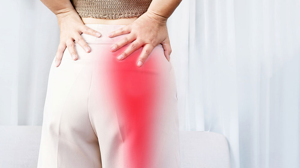 Sciatica: What You Need to Know