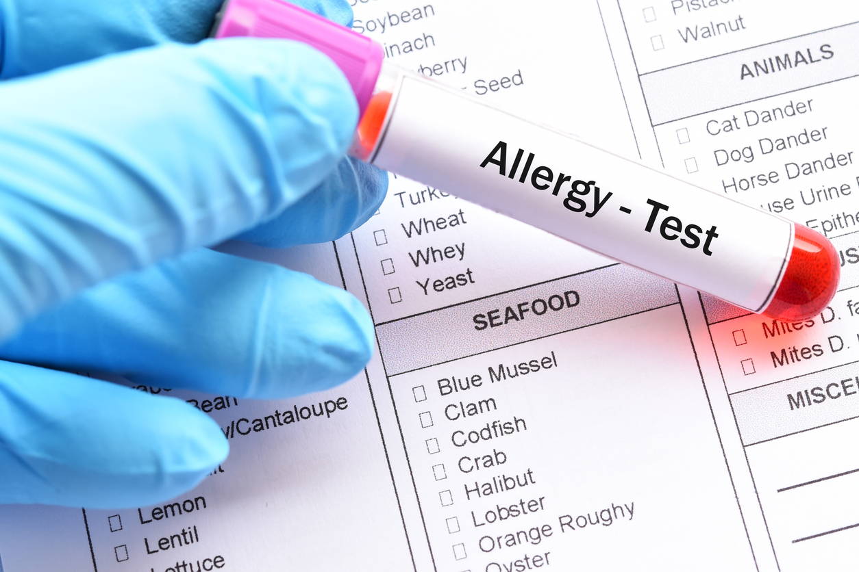 Major Food Allergens and When Testing Is Recommended