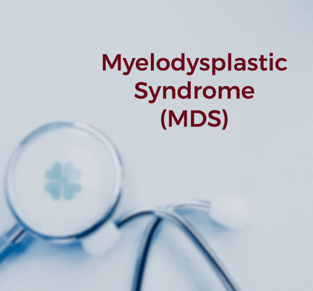 Understanding MDS Disease Treatment Options
