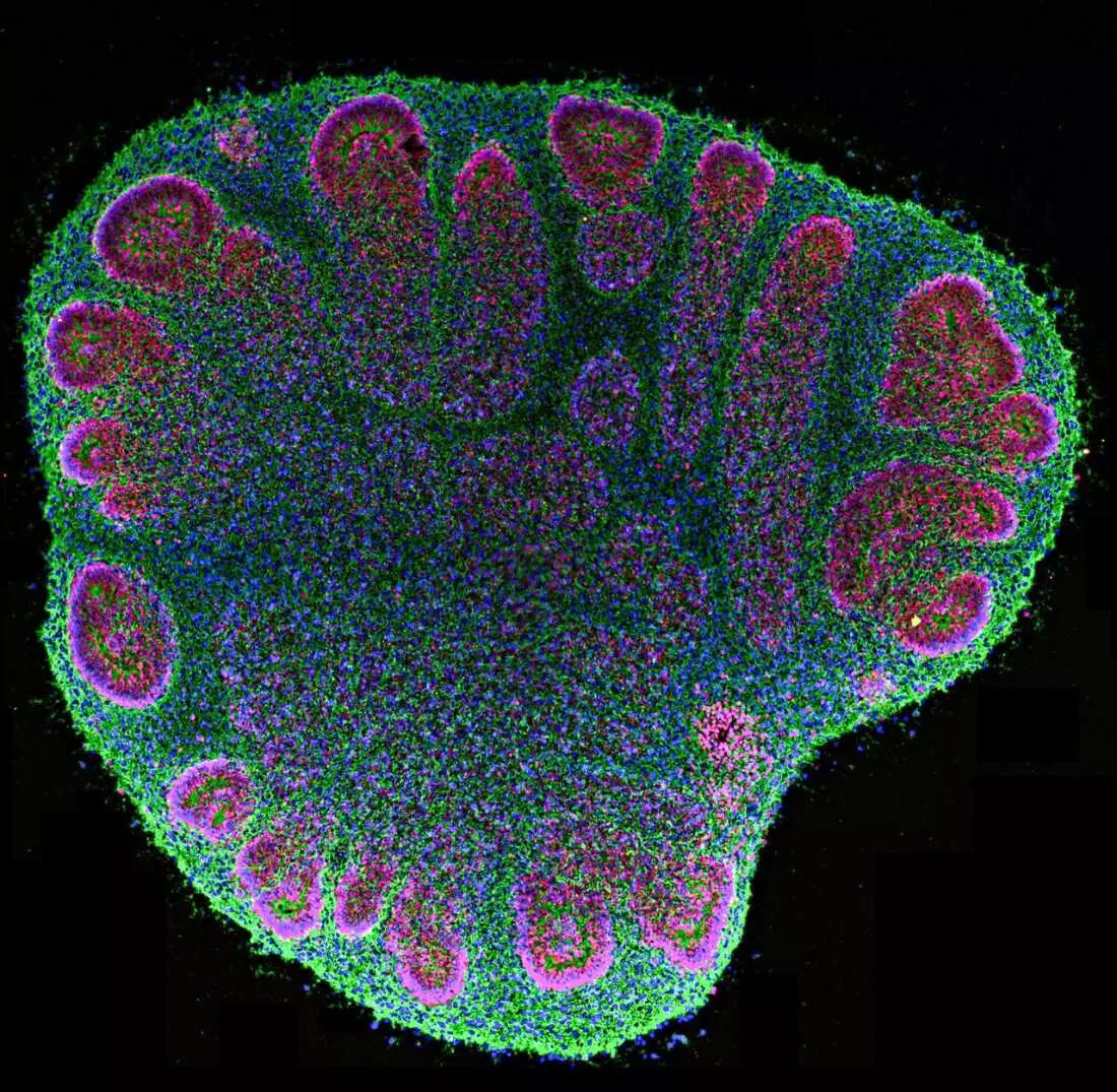 Brain Organoids: Advancements and Ethical Complexities in Neural Research