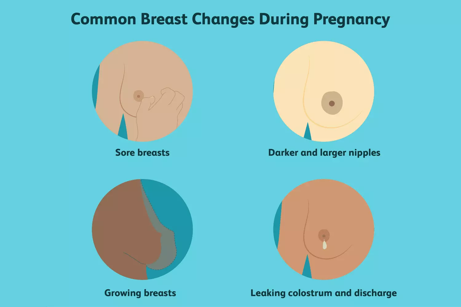 Understanding Breast Transformations During Pregnancy: A Comprehensive Guide