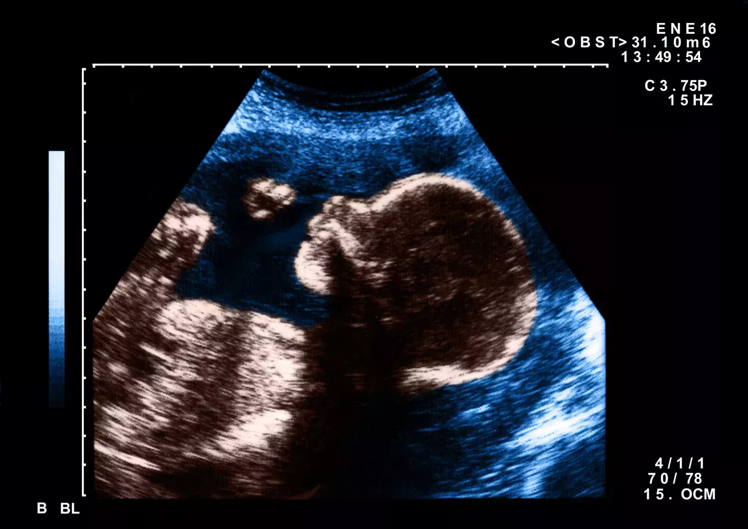 The Art and Impact of Pregnancy Nicknames