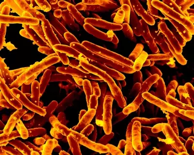 Revolutionizing Tuberculosis Diagnostics: A New Era of Swift and Accurate Detection